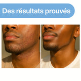 Baume Après-Rasage Keriane Blue – La Révolution Anti-Irritation